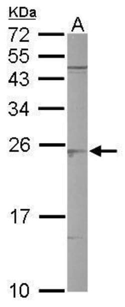 Invitrogen SAR1B Polyclonal Antibody 100 &mu;L | Buy Online | Invitrogen&trade; | Fisher Scientific