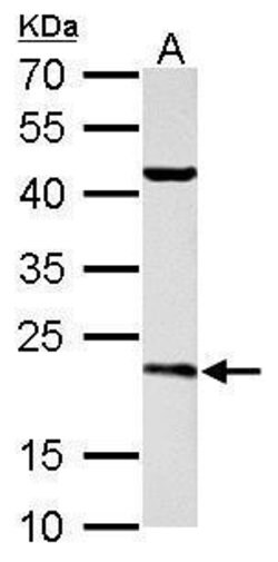 Invitrogen SAR1B Polyclonal Antibody 100 &mu;L | Buy Online | Invitrogen&trade; | Fisher Scientific
