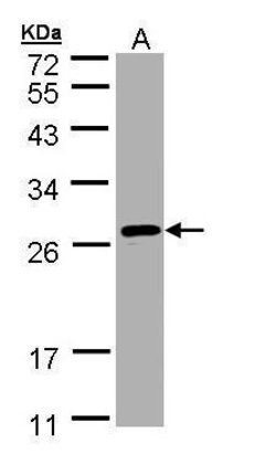 Invitrogen SAR1B Polyclonal Antibody 100 &mu;L | Buy Online | Invitrogen&trade; | Fisher Scientific