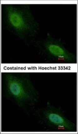 Invitrogen Aprataxin Polyclonal Antibody 100 &mu;L | Buy Online | Invitrogen&trade; | Fisher Scientific
