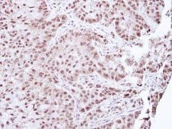 Invitrogen Aprataxin Polyclonal Antibody 100 &mu;L | Buy Online | Invitrogen&trade; | Fisher Scientific