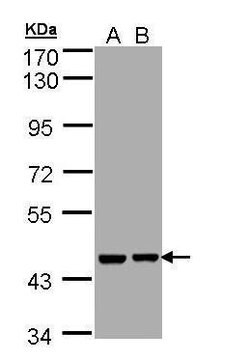 Invitrogen Aprataxin Polyclonal Antibody 100 &mu;L | Buy Online | Invitrogen&trade; | Fisher Scientific