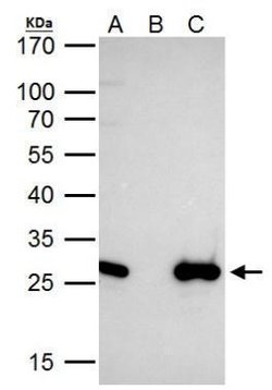 Invitrogen EN2 Polyclonal Antibody 100 &mu;L; Unconjugated:Antibodies,