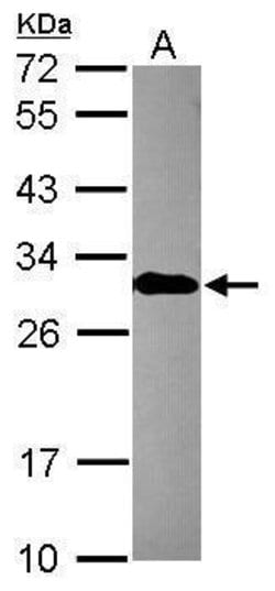 Invitrogen EN2 Polyclonal Antibody 100 &mu;L; Unconjugated:Antibodies,