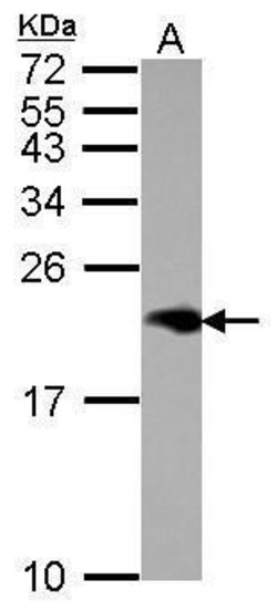 Invitrogen NPC2 Polyclonal Antibody 100 &mu;L | Buy Online | Invitrogen&trade; | Fisher Scientific