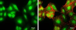 CHOP Polyclonal Antibody:Antibodies, Polyclonal
