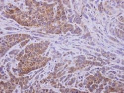 Invitrogen AKR1D1 Polyclonal Antibody 100 &mu;L | Buy Online | Invitrogen&trade; | Fisher Scientific