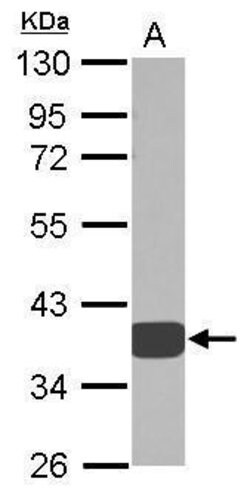 Invitrogen AKR1D1 Polyclonal Antibody 100 &mu;L | Buy Online | Invitrogen&trade; | Fisher Scientific