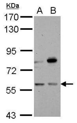 Invitrogen CNDP1 Polyclonal Antibody 100 &mu;L; Unconjugated:Antibodies,