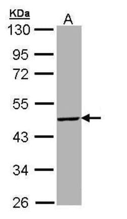 Invitrogen TBX19 Polyclonal Antibody 100 &mu;L | Buy Online | Invitrogen&trade; | Fisher Scientific