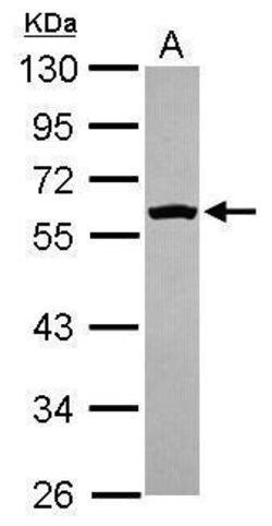 Invitrogen Fyn Polyclonal Antibody 100 &mu;L | Buy Online | Invitrogen&trade; | Fisher Scientific