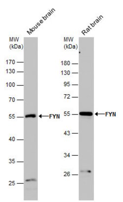 Invitrogen Fyn Polyclonal Antibody 100 &mu;L | Buy Online | Invitrogen&trade; | Fisher Scientific
