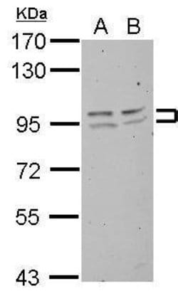 Invitrogen FXR2 Polyclonal Antibody 100 &mu;L | Buy Online | Invitrogen&trade; | Fisher Scientific