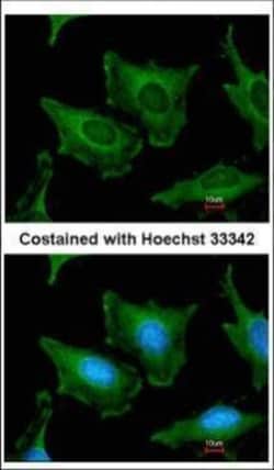 Invitrogen SEC23A Polyclonal Antibody 100 &mu;L | Buy Online | Invitrogen&trade; | Fisher Scientific
