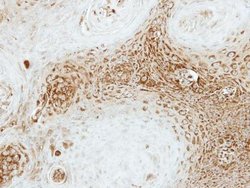 Invitrogen SEC23A Polyclonal Antibody 100 &mu;L; Unconjugated:Antibodies,
