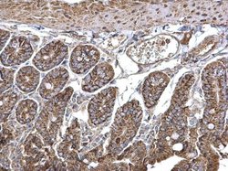 Invitrogen SEC23A Polyclonal Antibody 100 &mu;L; Unconjugated:Antibodies,