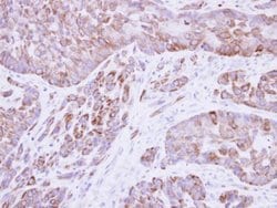 Invitrogen Cytokeratin 8 Polyclonal Antibody 100 &mu;L; Unconjugated:Antibodies,