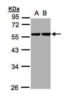 Invitrogen Cytokeratin 8 Polyclonal Antibody 100 &mu;L; Unconjugated:Antibodies,