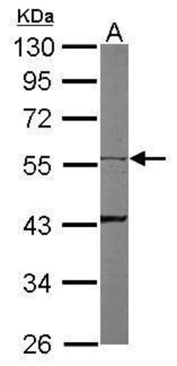 Invitrogen Cytokeratin 8 Polyclonal Antibody 100 &mu;L; Unconjugated:Antibodies,