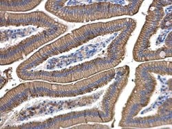 Invitrogen Cytokeratin 8 Polyclonal Antibody 100 &mu;L; Unconjugated:Antibodies,