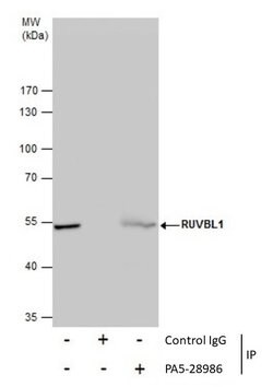 Invitrogen RUVBL1 Polyclonal Antibody 100 μL; Unconjugated:Antibodies,