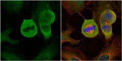 Invitrogen MAD1 Polyclonal Antibody 100 μL; Unconjugated:Antibodies,
