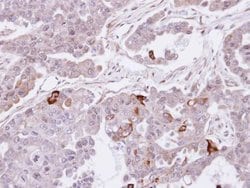 Invitrogen SEMA4A Polyclonal Antibody 100 &mu;L; Unconjugated:Antibodies,