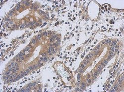 Invitrogen TNNT1 Polyclonal Antibody 100 &mu;L; Unconjugated:Antibodies,