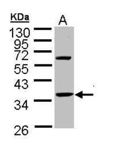 Invitrogen TNNT1 Polyclonal Antibody 100 &mu;L; Unconjugated:Antibodies,