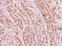 Invitrogen KHK Polyclonal Antibody 100 &mu;L; Unconjugated:Antibodies,