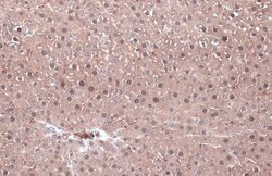 Invitrogen KHK Polyclonal Antibody 100 &mu;L; Unconjugated:Antibodies,