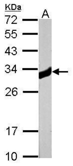 Invitrogen KHK Polyclonal Antibody 100 &mu;L; Unconjugated:Antibodies,