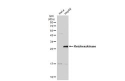 Invitrogen KHK Polyclonal Antibody 100 &mu;L; Unconjugated:Antibodies,