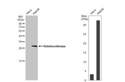 Invitrogen KHK Polyclonal Antibody 100 &mu;L; Unconjugated:Antibodies,