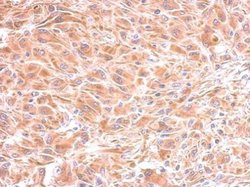 Invitrogen IMPA1 Polyclonal Antibody 100 &mu;L; Unconjugated:Antibodies,