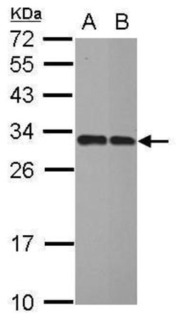 Invitrogen IMPA1 Polyclonal Antibody 100 &mu;L; Unconjugated:Antibodies,
