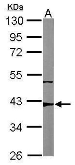 Invitrogen p53R2 Polyclonal Antibody 100 &mu;L | Buy Online | Invitrogen&trade; | Fisher Scientific