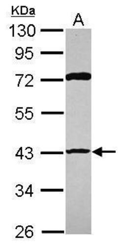 Invitrogen p53R2 Polyclonal Antibody 100 &mu;L | Buy Online | Invitrogen&trade; | Fisher Scientific