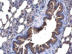 Invitrogen p53R2 Polyclonal Antibody 100 &mu;L | Buy Online | Invitrogen&trade; | Fisher Scientific