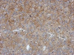 CCR5 Polyclonal Antibody, Invitrogen 100 &mu;L | Buy Online | Invitrogen | Fisher Scientific