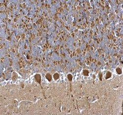 Invitrogen PGP9.5 Polyclonal Antibody 100 &mu;L; Unconjugated:Antibodies,