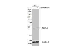 Invitrogen PGP9.5 Polyclonal Antibody 100 &mu;L; Unconjugated:Antibodies,