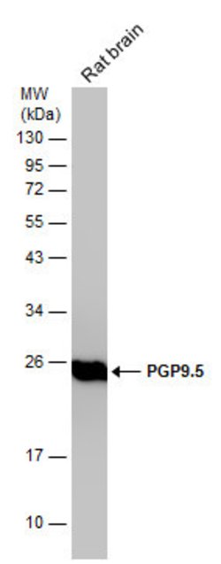 Invitrogen PGP9.5 Polyclonal Antibody 100 &mu;L; Unconjugated:Antibodies,