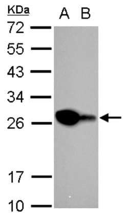 Invitrogen PGP9.5 Polyclonal Antibody 100 &mu;L; Unconjugated:Antibodies,
