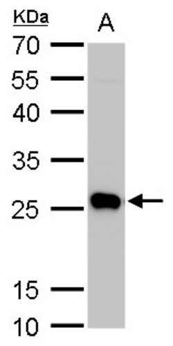 Invitrogen PGP9.5 Polyclonal Antibody 100 &mu;L; Unconjugated:Antibodies,