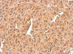 Invitrogen RAB5 Polyclonal Antibody 100 &mu;L; Unconjugated:Antibodies,