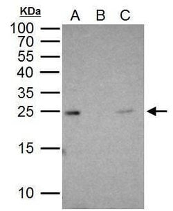 Invitrogen RAB5 Polyclonal Antibody 100 &mu;L; Unconjugated:Antibodies,