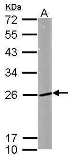 Invitrogen RAB5 Polyclonal Antibody 100 &mu;L; Unconjugated:Antibodies,