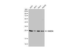 Invitrogen RAB5 Polyclonal Antibody 100 &mu;L | Buy Online | Invitrogen&trade; | Fisher Scientific