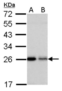 Invitrogen RAB5 Polyclonal Antibody 100 &mu;L; Unconjugated:Antibodies,